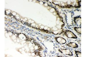 Anti- PKC epsilon Picoband antibody, IHC(P) IHC(P): Rat Intestine Tissue (PKC epsilon antibody  (AA 53-236))