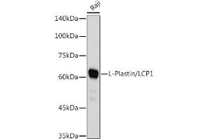 Western blot analysis of extracts of Raji cells, using L-Plastin/LCP1 antibody (ABIN7268317) at 1:1000 dilution. (LCP1 antibody)