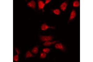 ABIN6269259 staining 293 by IF/ICC. (GATA4 antibody  (Internal Region))