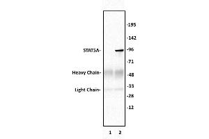 STAT5A antibody (pAb) tested by Immunoprecipitation. (STAT5A antibody  (C-Term))