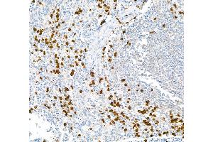 Immunohistochemistry (IHC) image for anti-S100 Calcium Binding Protein A9 (S100A9) (AA 64-114) antibody (ABIN7449432) (Recombinant S100A9 antibody  (AA 64-114))