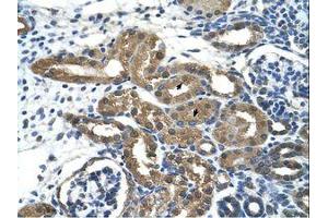 Image no. 1 for anti-Histone Deacetylase 9 (HDAC9) (C-Term) antibody (ABIN205000) (HDAC9 antibody  (C-Term))