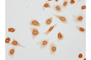 Immunocytochemistry analysis of ABIN7181447 diluted at 1:10 and staining in Hela cells(treated with 50nM Calyculin A for 30 min) performed on a Leica BondTM system. (Histone H1.3 antibody  (pThr146))