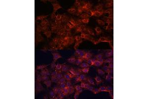 Immunofluorescence analysis of C6 cells using PDP2 antibody (ABIN7269776) at dilution of 1:100. (PDP2 antibody  (AA 67-250))