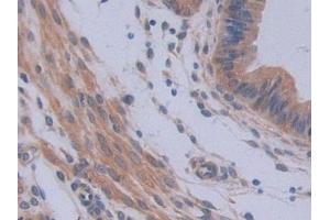 IHC-P analysis of Mouse Uterus Tissue, with DAB staining. (IL12A antibody  (AA 23-215))