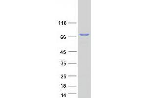 Validation with Western Blot (PRC1 Protein (Transcript Variant 1) (Myc-DYKDDDDK Tag))