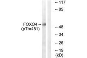Western blot analysis of extracts from HuvEc cells treated with EGF 200ng/ml 5', using FOXO4 (Phospho-Thr451) Antibody. (FOXO4 antibody  (pThr451))