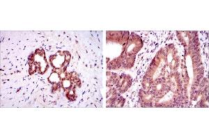 Immunohistochemistry (IHC) image for anti-Orthodenticle Homeobox 2 (OTX2) antibody (ABIN969332)