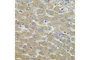 Immunohistochemistry of paraffin-embedded human liver injury using AQP5 antibody (ABIN6003635) (40x lens).