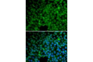 Immunofluorescence analysis of HeLa cells using GGH antibody (ABIN5973177). (GGH antibody)
