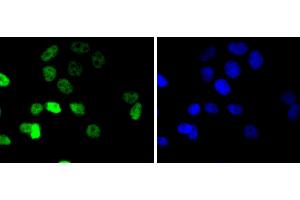 MCF-7 cells were stained with Cyclin E1 (4H7) Monoclonal Antibody  at [1:200] incubated overnight at 4C, followed by secondary antibody incubation, DAPI staining of the nuclei and detection. (Cyclin E1 antibody)