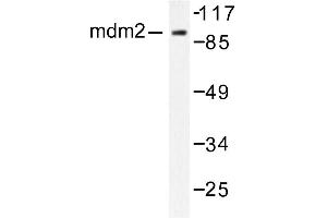 Image no. 1 for anti-Mdm2, p53 E3 Ubiquitin Protein Ligase Homolog (Mouse) (MDM2) antibody (ABIN265516) (MDM2 antibody)