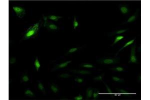 Immunofluorescence of monoclonal antibody to PSME2 on HeLa cell. (PSME2 antibody  (AA 1-239))