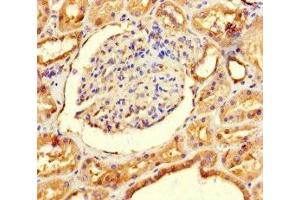 Immunohistochemistry of paraffin-embedded human kidney tissue using ABIN7143697 at dilution of 1:100 (GALM antibody  (AA 2-342))