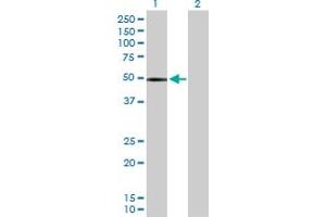 Western Blot analysis of CHIT1 expression in transfected 293T cell line by CHIT1 MaxPab polyclonal antibody. (Chitotriosidase 1 antibody  (AA 1-466))