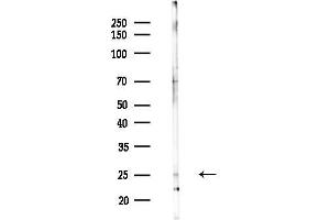 anti-C-Type Lectin Domain Family 7, Member A (CLEC7A) (Internal Region) antibody