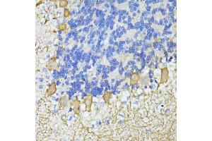 Immunohistochemistry of paraffin-embedded mouse cerebellum using C antibody  at dilution of 1:100 (40x lens). (CA8 antibody  (AA 1-290))