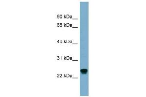 RAB22A antibody used at 1 ug/ml to detect target protein. (RAB22A antibody  (Middle Region))