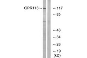 Western blot analysis of extracts from LOVO cells, using GPR113 Antibody. (GPR113 antibody  (AA 21-70))