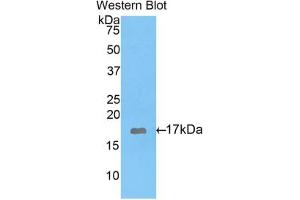 Western blot analysis of the recombinant protein. (GAD antibody  (AA 1-97))