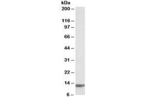 Western blot testing of human duodenum lysate with B2M antibody at 0. (beta-2 Microglobulin antibody)