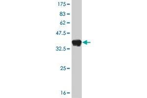 Western Blot detection against Immunogen (37. (FOXA1 antibody  (AA 367-472))