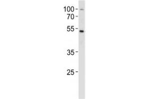 SOX4 antibody western blot analysis in MCF-7 lysate. (SOX4 antibody  (AA 269-297))