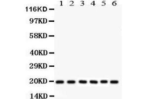 Anti- PIN1 Picoband antibody, Western blotting All lanes: Anti PIN1  at 0. (PIN1 antibody  (AA 1-163))
