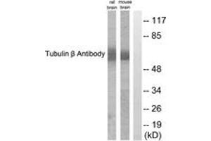 Western blot analysis of extracts from mouse brain/rat brain cells, using Tubulin beta Antibody.