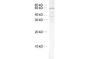 dilution: 1 : 1000, sample: crude synaptosomal fraction of rat brain (P2) (VPS45 antibody)