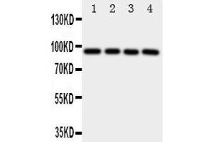 Western Blotting (WB) image for anti-Aryl Hydrocarbon Receptor (AHR) (AA 832-848), (C-Term) antibody (ABIN3043054)