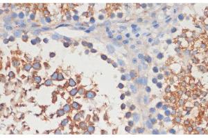 Immunohistochemistry of paraffin-embedded Rat testis using CDC42 Polyclonal Antibody at dilution of 1:100 (40x lens). (CDC42 antibody)