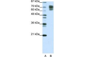 Western Blotting (WB) image for anti-Catenin (Cadherin-Associated Protein), beta 1, 88kDa (CTNNB1) antibody (ABIN2463774) (CTNNB1 antibody)