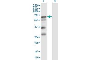 Western Blot analysis of SERPINA10 expression in transfected 293T cell line by SERPINA10 MaxPab polyclonal antibody. (SERPINA10 antibody  (AA 1-444))