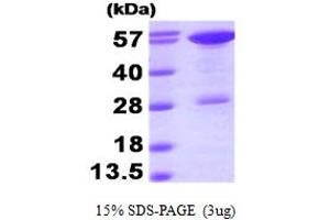 SDS-PAGE (SDS) image for Stress-Induced-phosphoprotein 1 (STIP1) (AA 1-543) protein (His tag) (ABIN668048)
