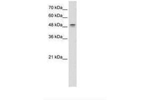 Image no. 1 for anti-Dihydroorotate Dehydrogenase (DHODH) (AA 101-150) antibody (ABIN6736624) (DHODH antibody  (AA 101-150))