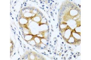 Immunohistochemistry of paraffin-embedded Human colon using PRKCA Polyclonal Antibody at dilution of 1:100 (40x lens). (PKC alpha antibody)