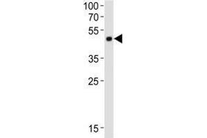 Western blot analysis of lysate from mouse cerebellum tissue lysate using Pax6 antibody diluted at 1:1000. (PAX6 antibody  (C-Term))