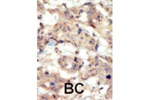 Immunohistochemistry (IHC) image for anti-EPH Receptor B6 (EPHB6) antibody (ABIN5023506) (EPH Receptor B6 antibody)