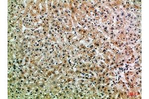 Immunohistochemical analysis of paraffin-embedded Human-liver, antibody was diluted at 1:100 (PPP1R13B antibody  (AA 630-680))