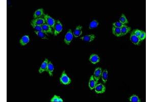 Immunofluorescent analysis of HepG2 cells using ABIN7142316 at dilution of 1:100 and Alexa Fluor 488-congugated AffiniPure Goat Anti-Rabbit IgG(H+L) (ACAA2 antibody  (AA 188-257))