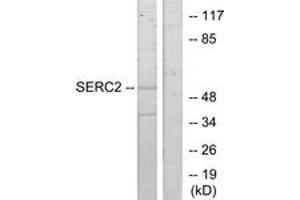 Western blot analysis of extracts from HeLa cells, using SERC2 Antibody.