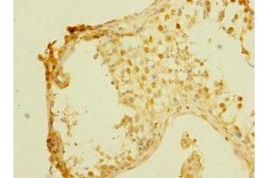 Immunohistochemistry of paraffin-embedded human testis tissue using ABIN7158910 at dilution of 1:100 (MPP6 antibody  (AA 220-420))