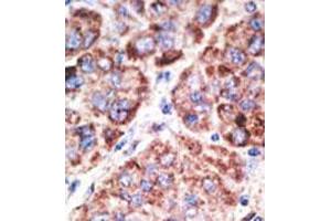 Image no. 2 for anti-Toll-Like Receptor 6 (TLR6) (N-Term) antibody (ABIN357054) (TLR6 antibody  (N-Term))