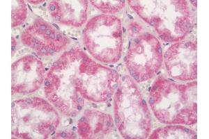Immunohistochemistry (Paraffin-embedded Sections) (IHC (p)) image for anti-Nuclear Factor of kappa Light Polypeptide Gene Enhancer in B-Cells Inhibitor, delta (NFKBID) (AA 91-119) antibody (ABIN2586152)
