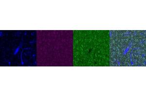 Immunohistochemistry (IHC) image for anti-Insulin-Like Growth Factor Binding Protein 6 (IGFBP6) antibody (ABIN7455987) (IGFBP6 antibody)