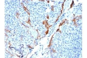 Formalin-fixed, paraffin-embedded human Tonsil stained with Cytokeratin 16 Mouse Recombinant Monoclonal Antibody (KRT16/1714). (Recombinant KRT16 antibody  (C-Term))