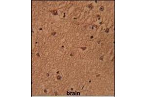 Figure 2. (BRISC and BRCA1 A Complex Member 1 (BABAM1) (Middle Region) antibody)