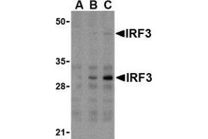 Western blot analysis of IRF3 in U937 whole cell lysate with AP30448PU-N IRF3 antibody at (A) 1, (B) 2, and (C) 4 μg/ml. (IRF3 antibody  (Intermediate Domain))