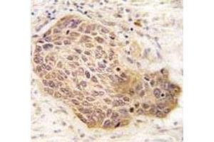 Immunohistochemistry (IHC) image for anti-Receptor-Interacting Serine-threonine Kinase 2 (RIPK2) (AA 458-488) antibody (ABIN3032446)